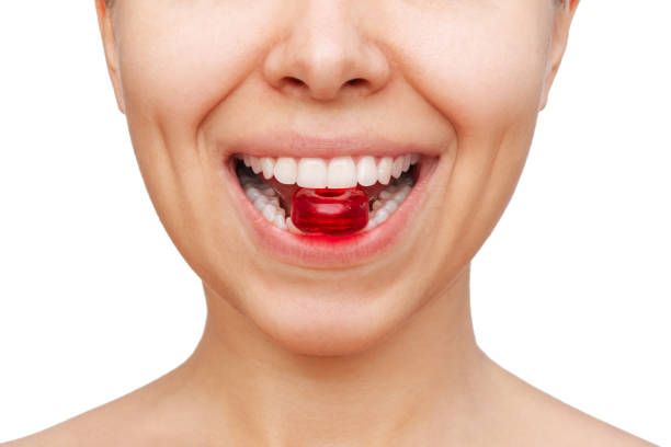 Advantages of Hollywood Smile