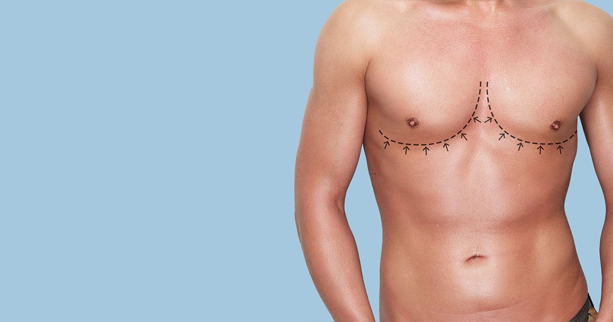 Who is affected by Gynecomastia?