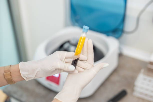 How to prepare for PRP (platelet-rich plasma) therapy?