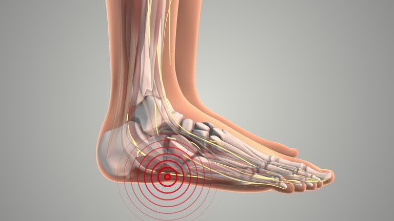 Peripheral nerve surgery recovery