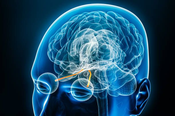 Neuro-ophthalmology cost in Iran