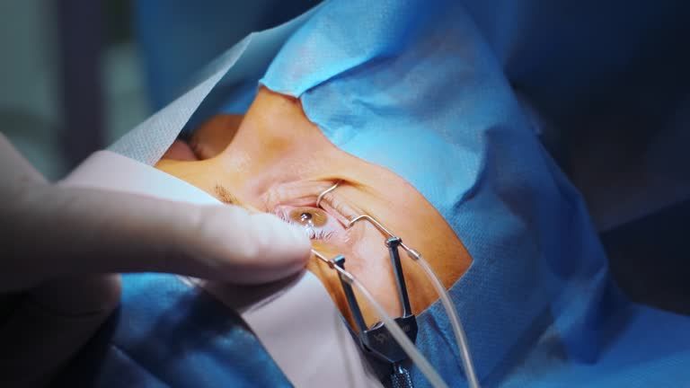 Retinal detachment repair surgeries