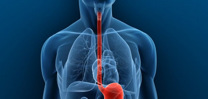 What is Esophagectomy?