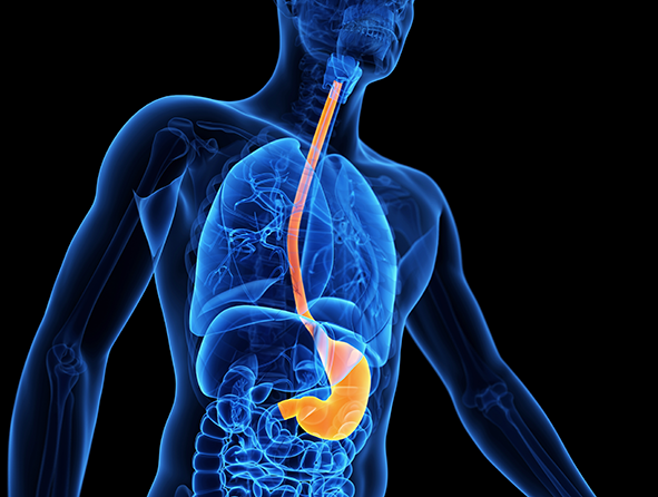 Preparing for Esophagectomy