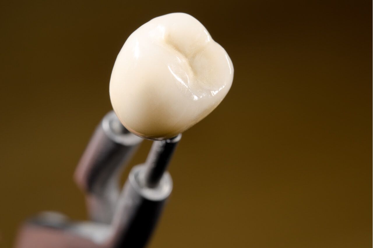 Dental Crown Procedure