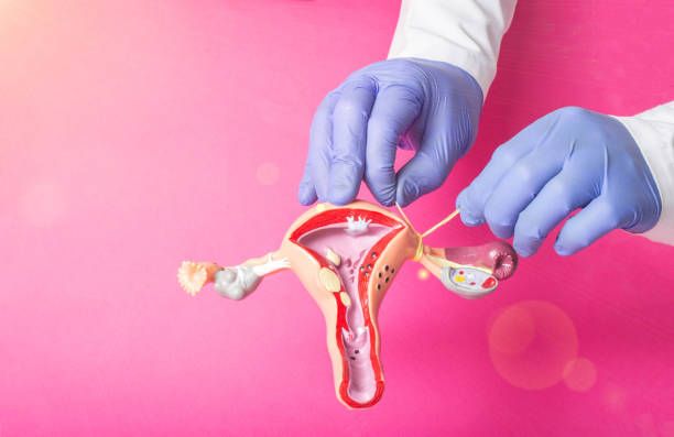 The advantages of Tubal Ligation