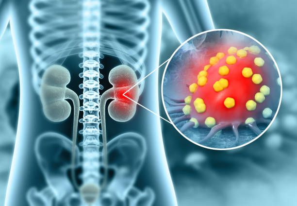 Causes of Nephrological Diseases