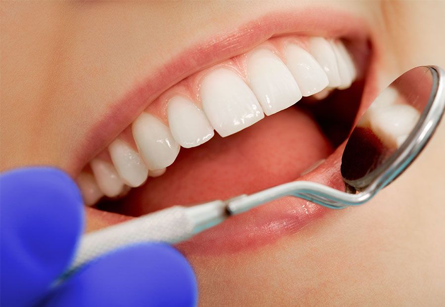 What is dental composite?