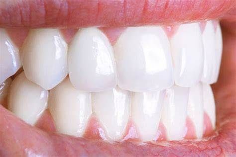 Teeth-Whitening Strips