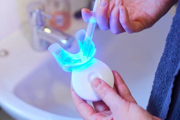 Teeth Whitening process