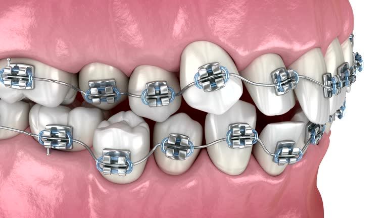 What is orthodontics?