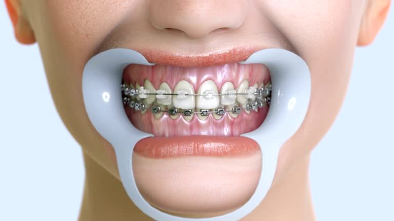 Common orthodontic problems