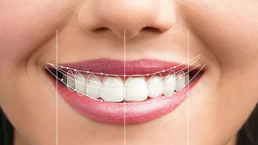 What are the types of Cosmetic Dentistry?