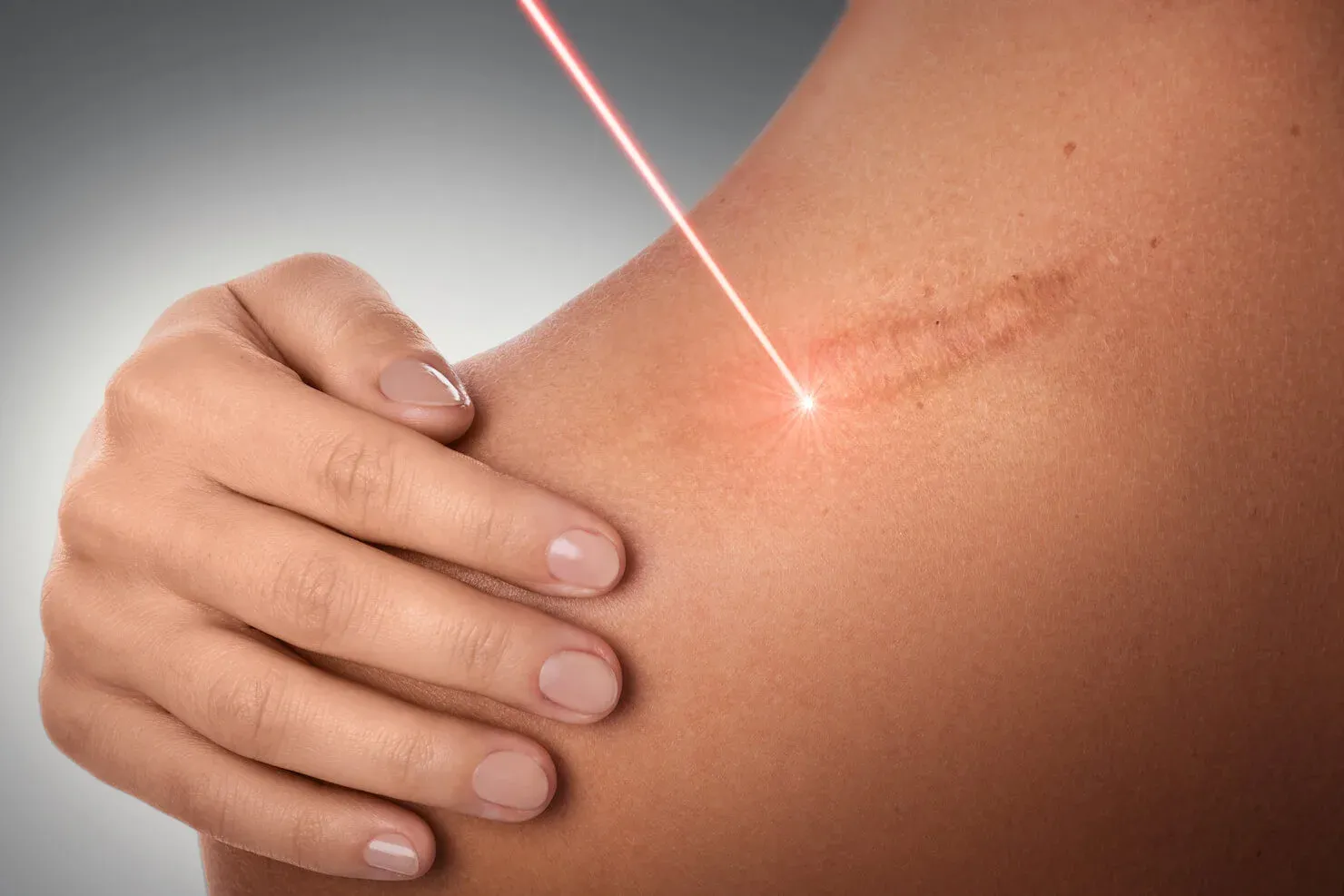 What Are the Best Options for Scar Removal?