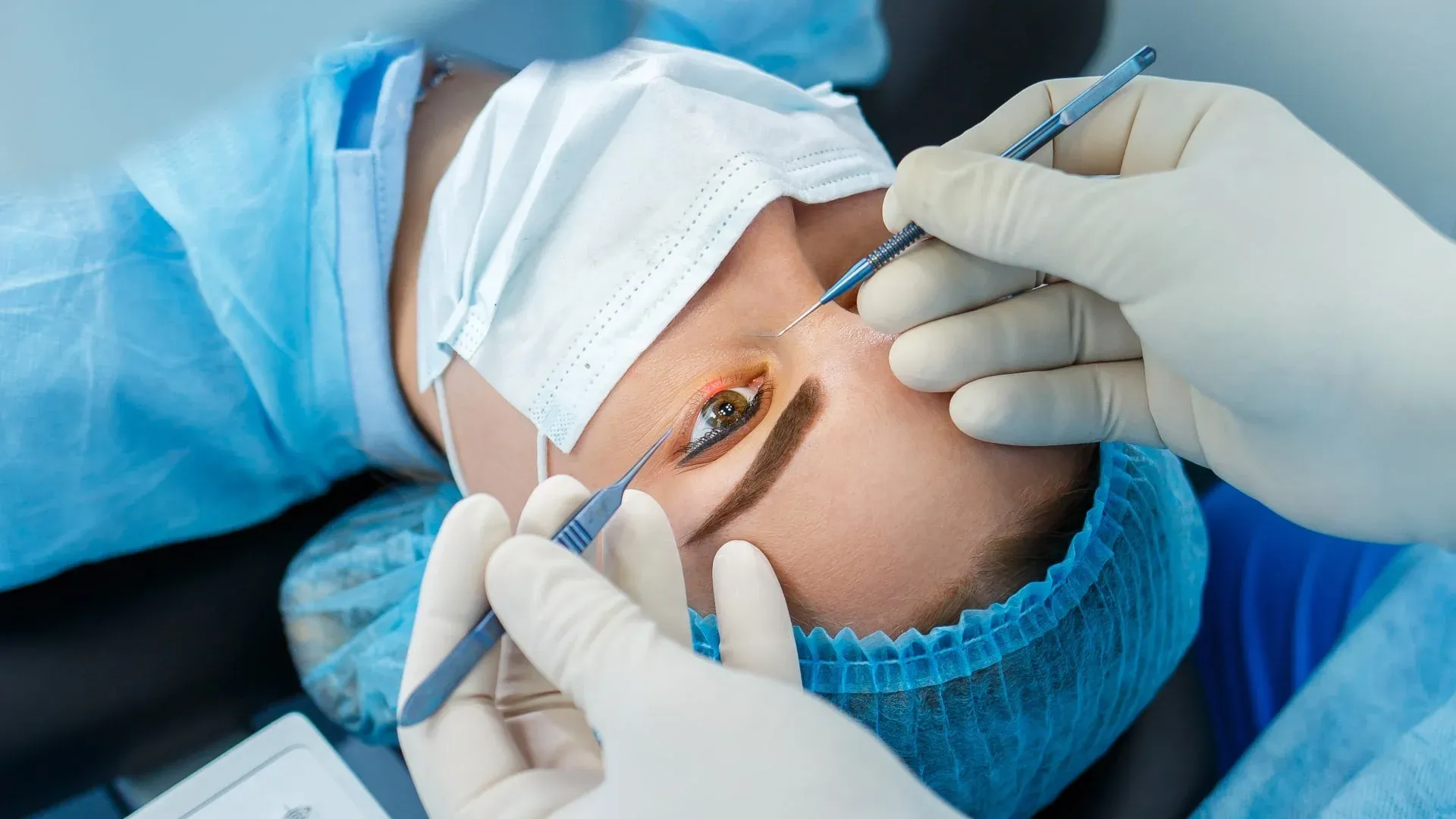 Pros and Cons of LASIK