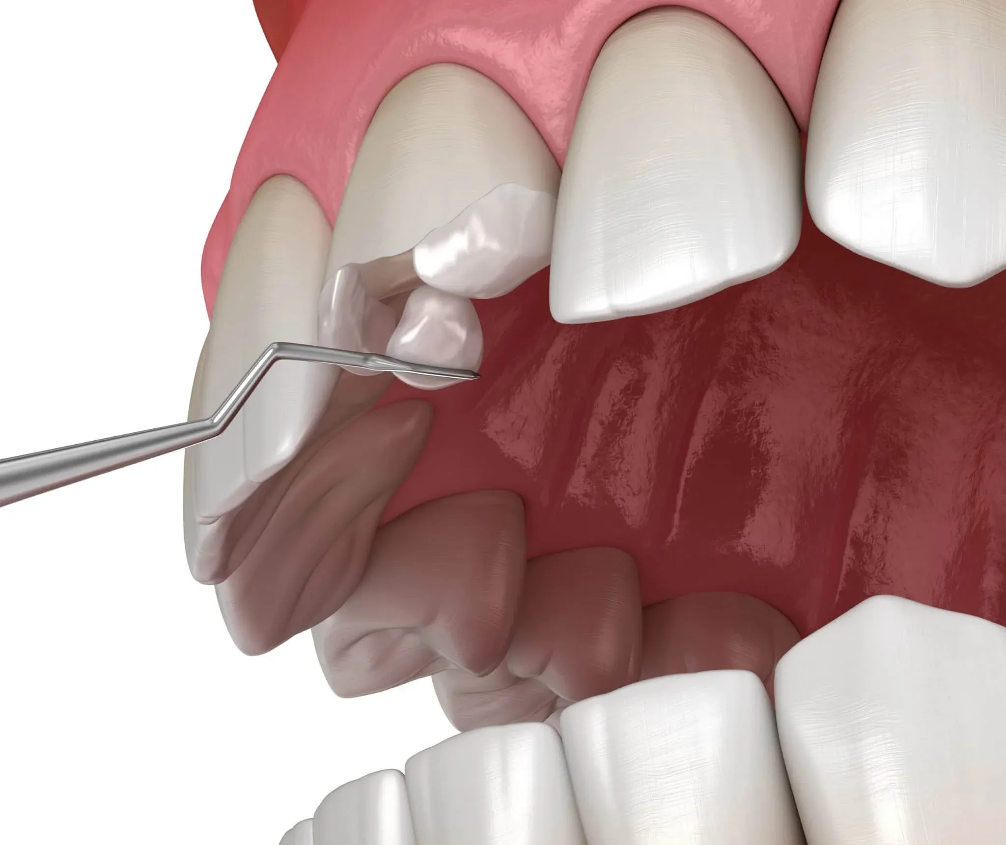 What is Restorative Dentistry?