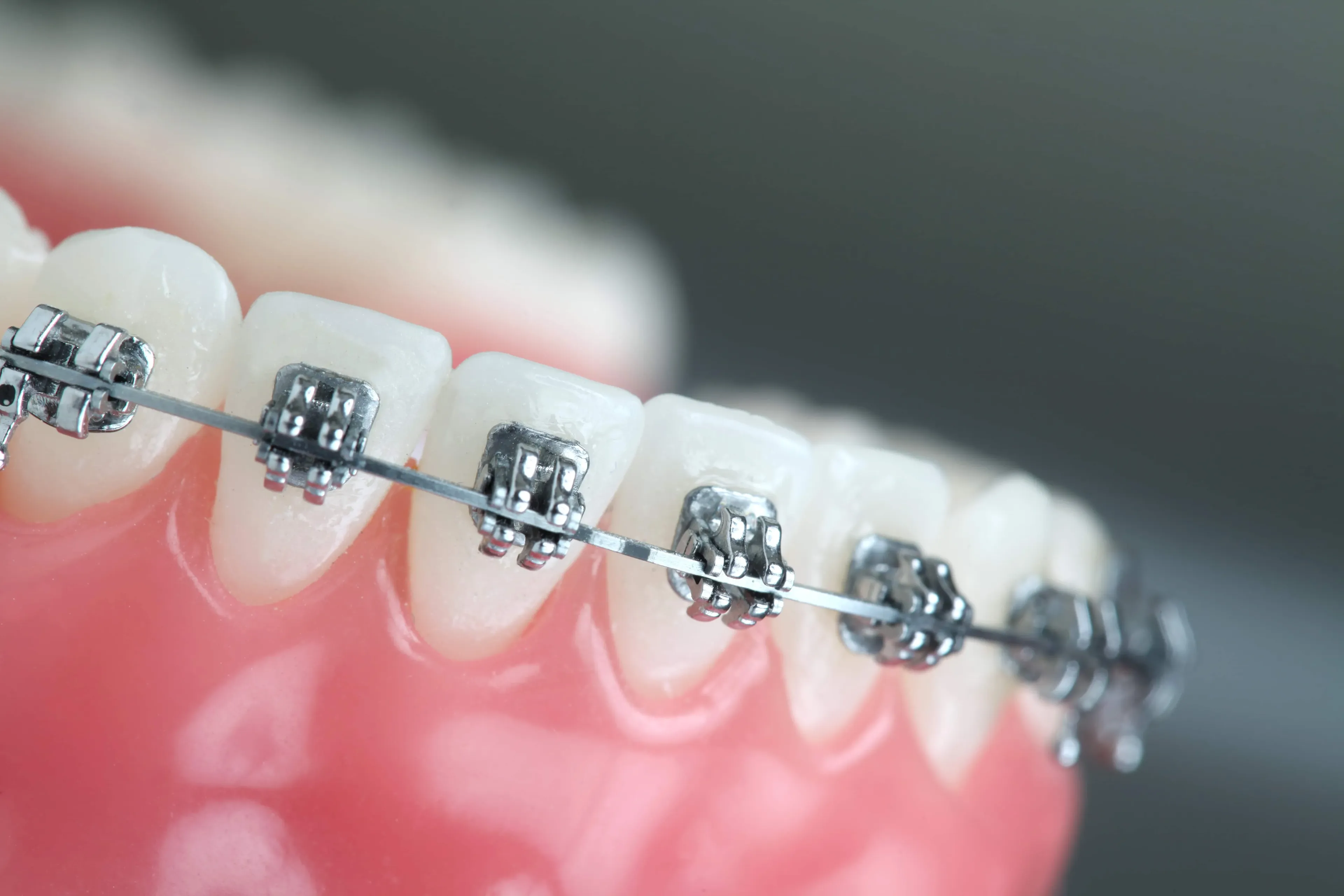 How does orthodontics work?