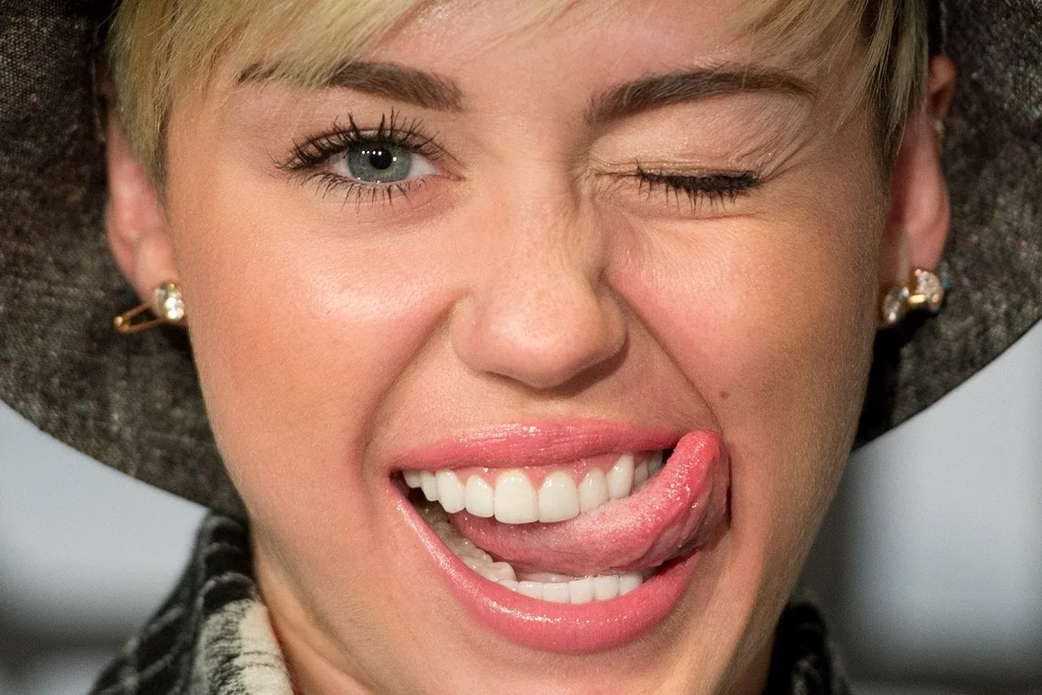 How Do Celebrities get such White Teeth?