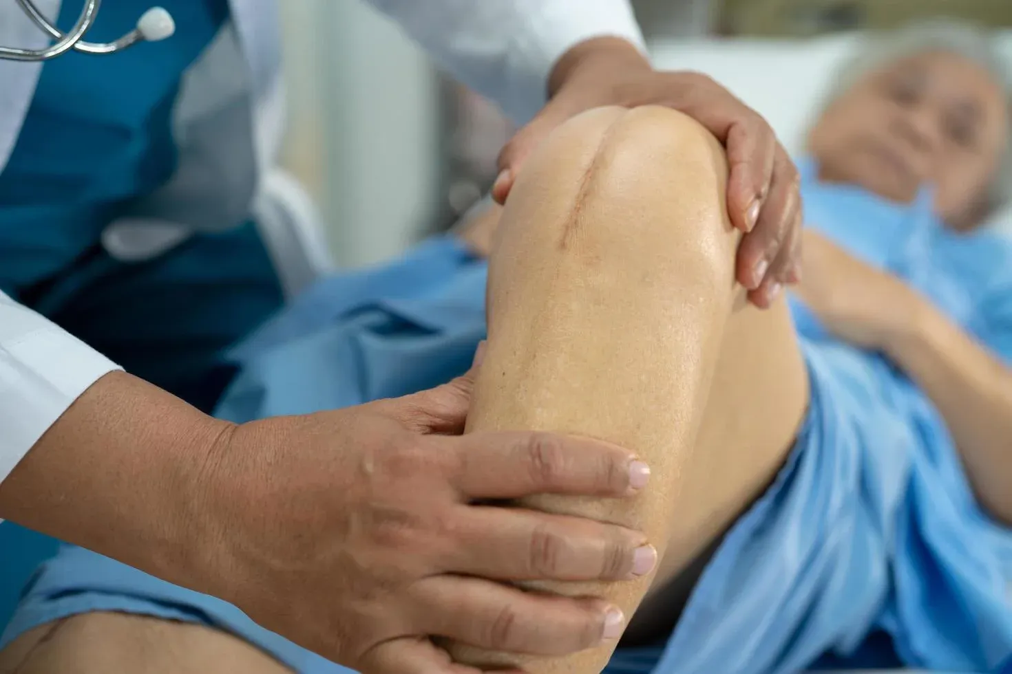 The pros and cons of Knee Replacement