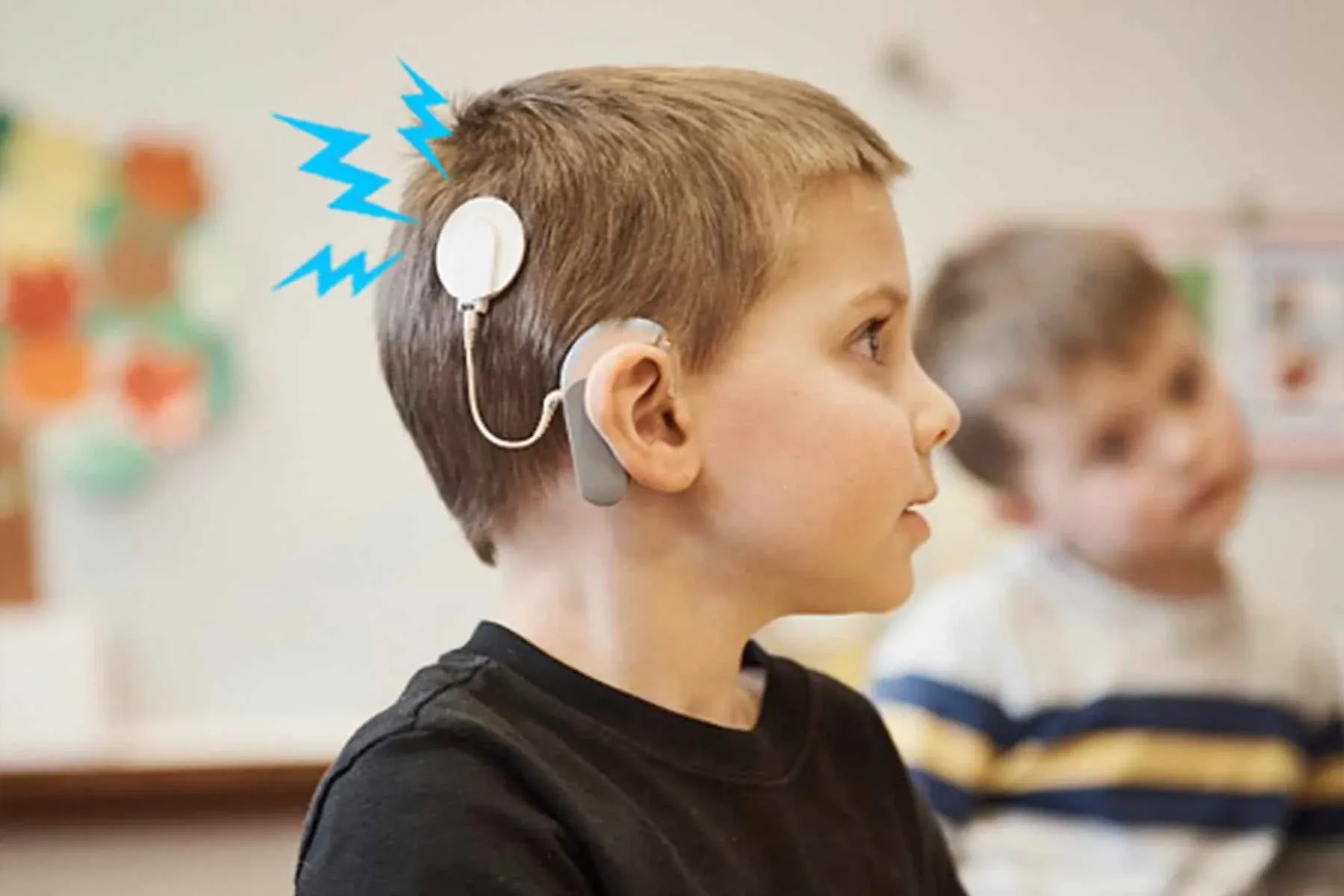 Cochlear Implant vs. Hearing Aid