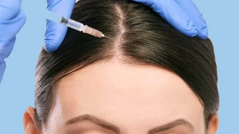 What is Mesotherapy treatment?