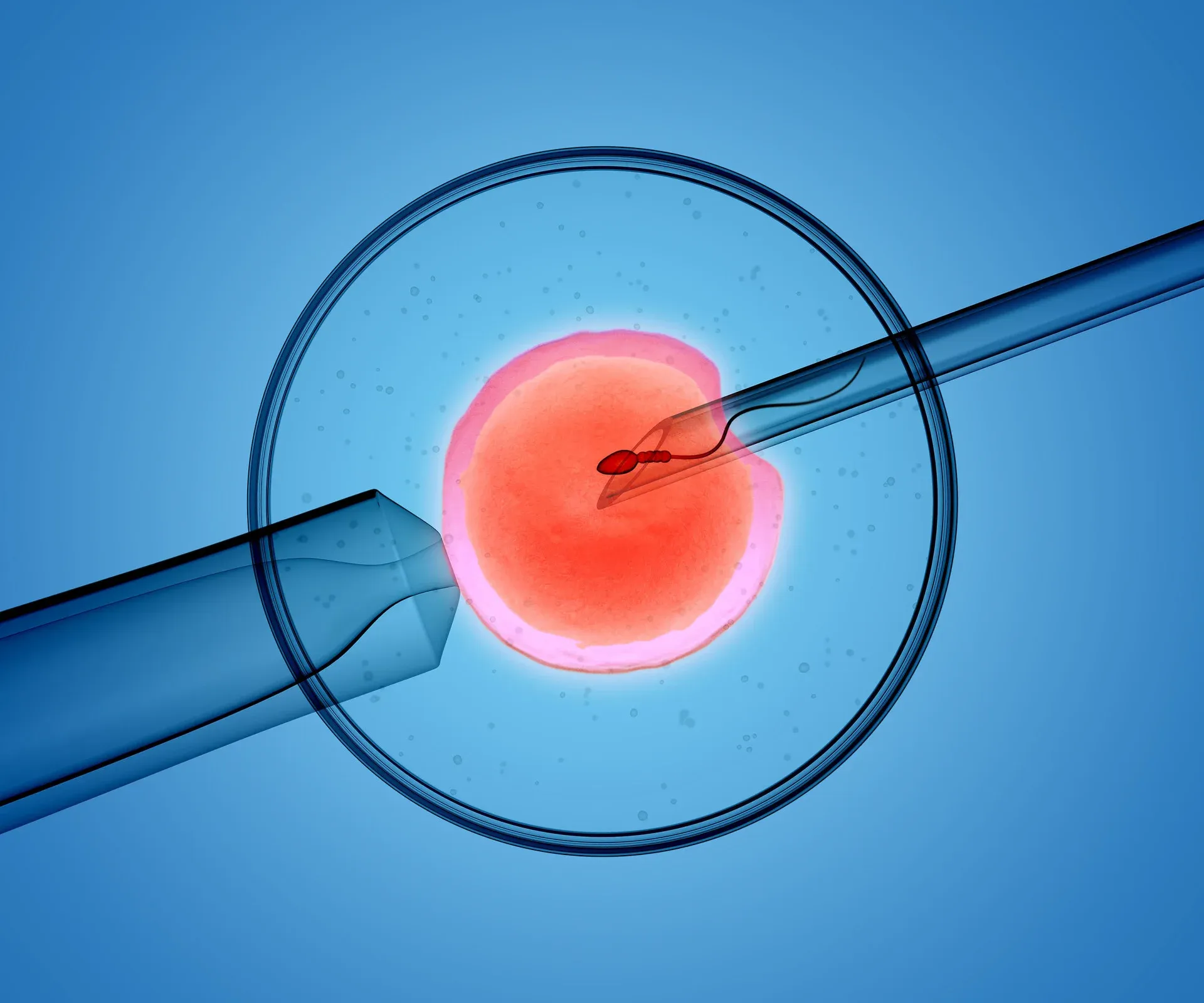 Female Infertility: Cause & Treatment