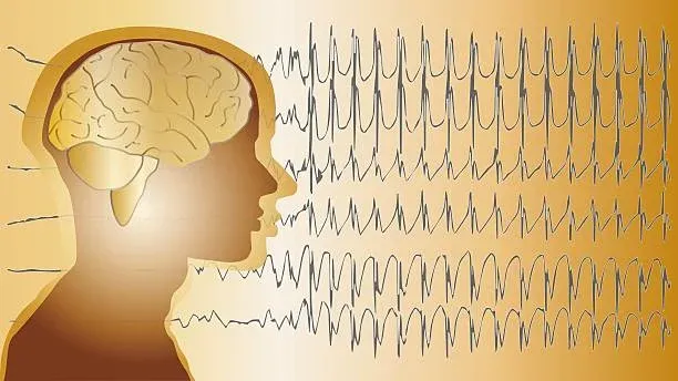 What Causes Epilepsy?