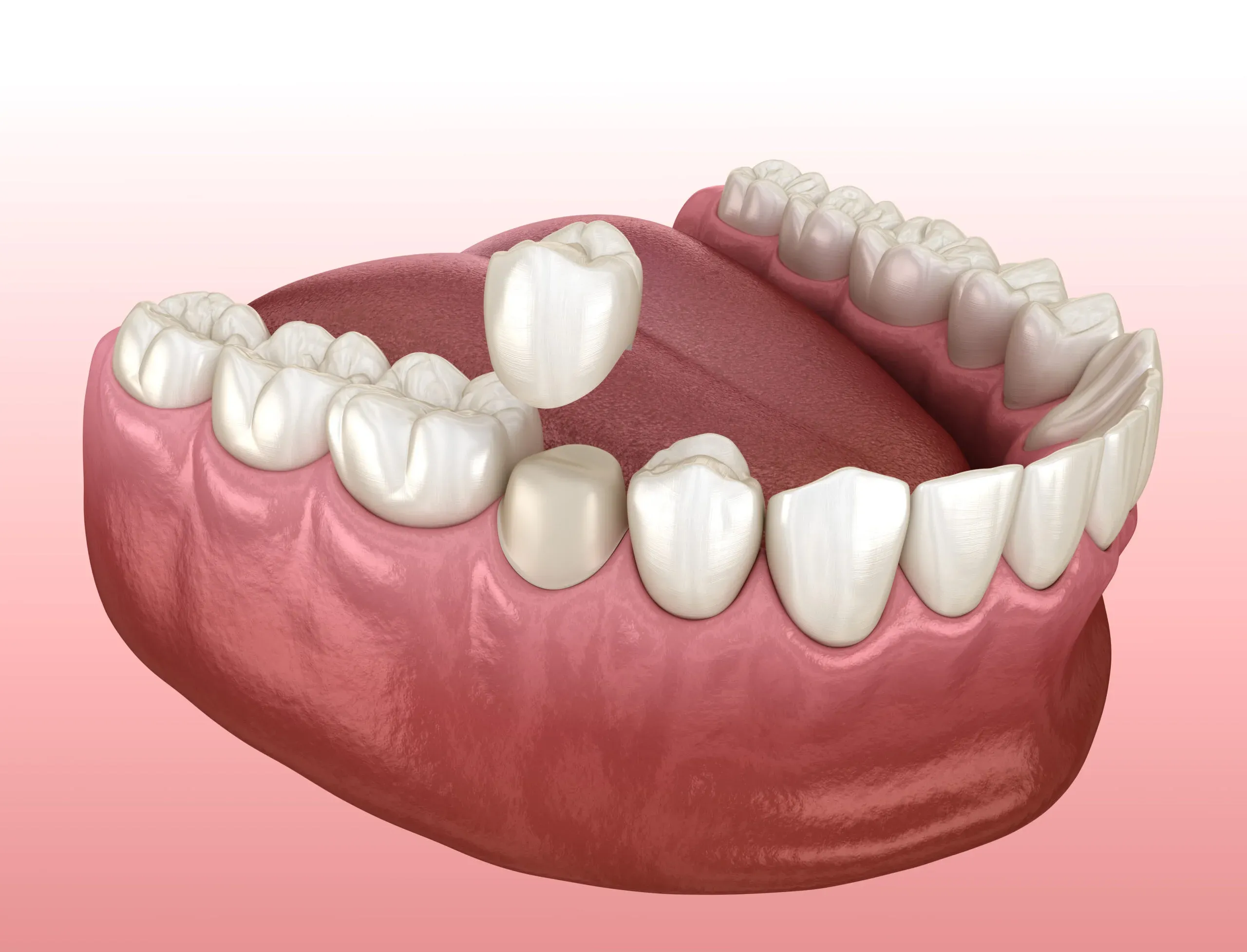 What is Restorative Dentistry?