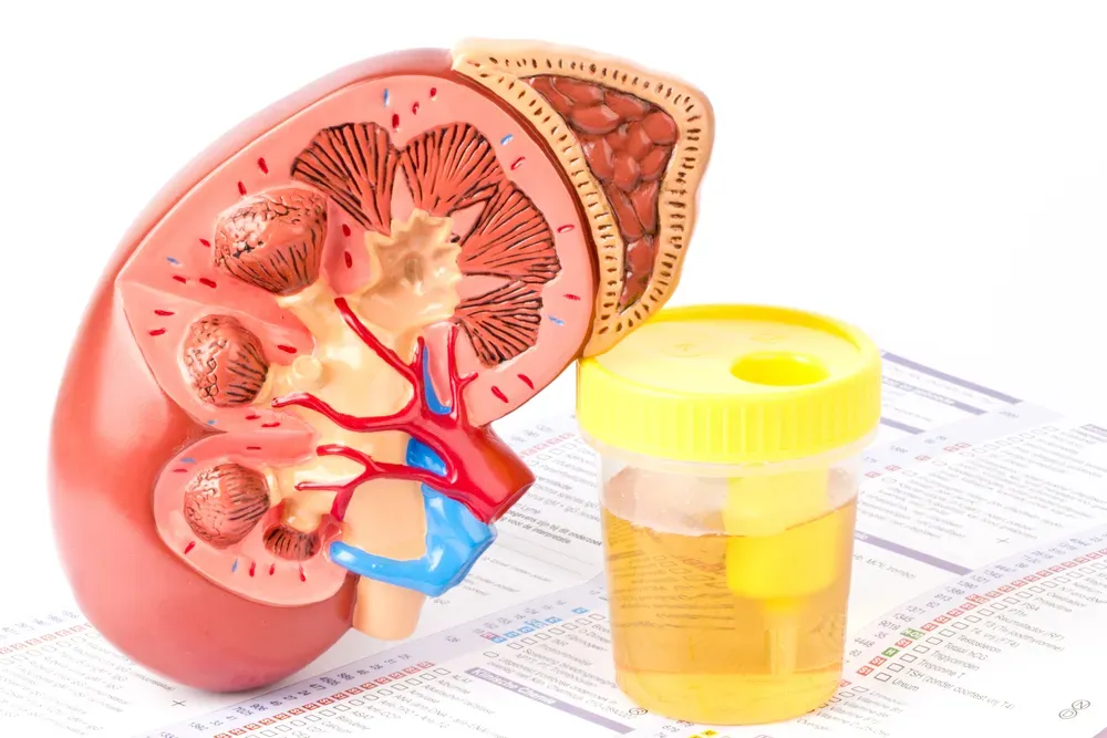 Kidney Transplant Surgery (Benefits, Risks, Side Effects)