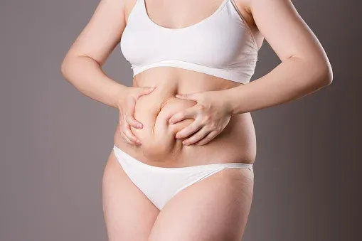 Is Tummy Tuck right for me?