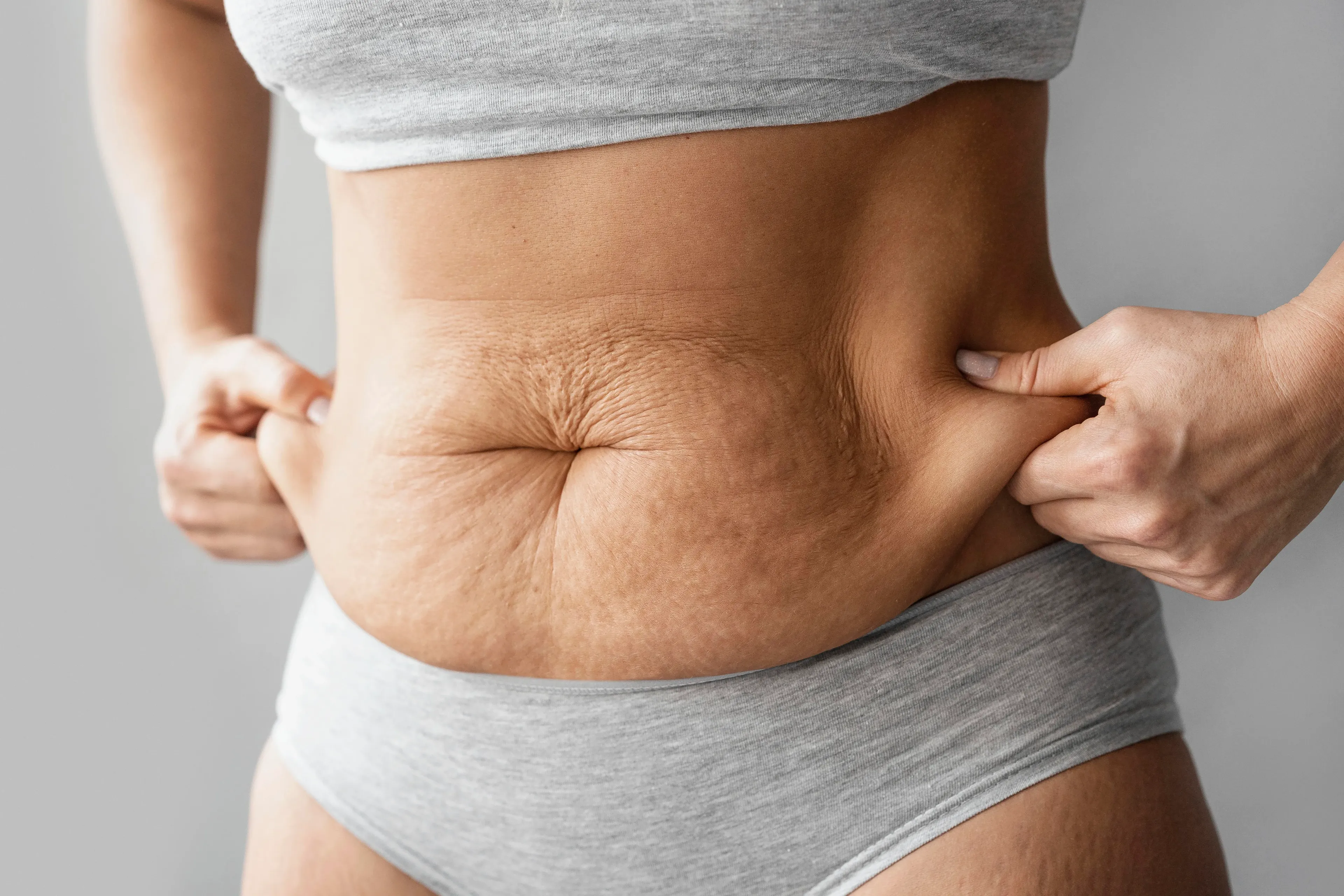 Is Abdominoplasty (Tummy Tuck) right for me?