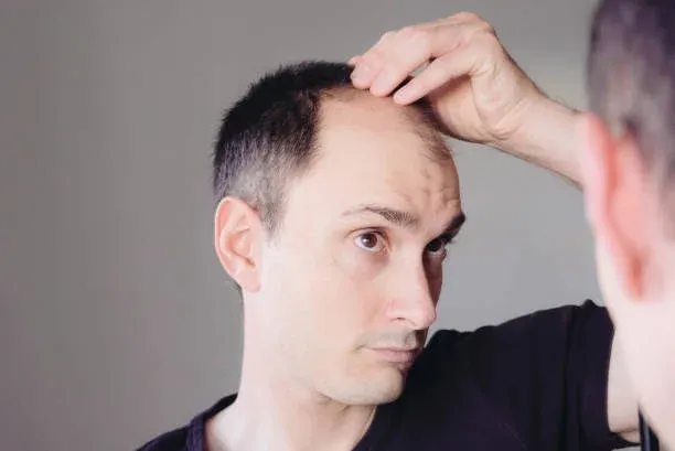 What are the side effects of Hair Transplant?