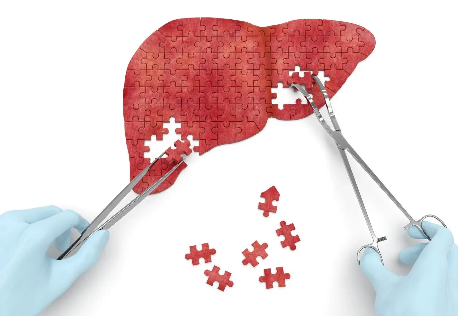 Liver Transplant: Criteria, Surgery, Procedure & Recovery