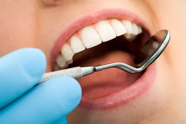 About Dental Composite