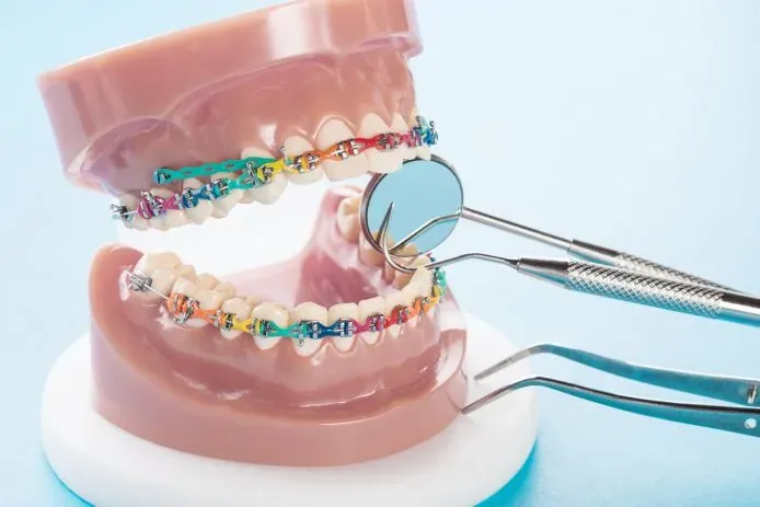 What are the benefits of having orthodontics?