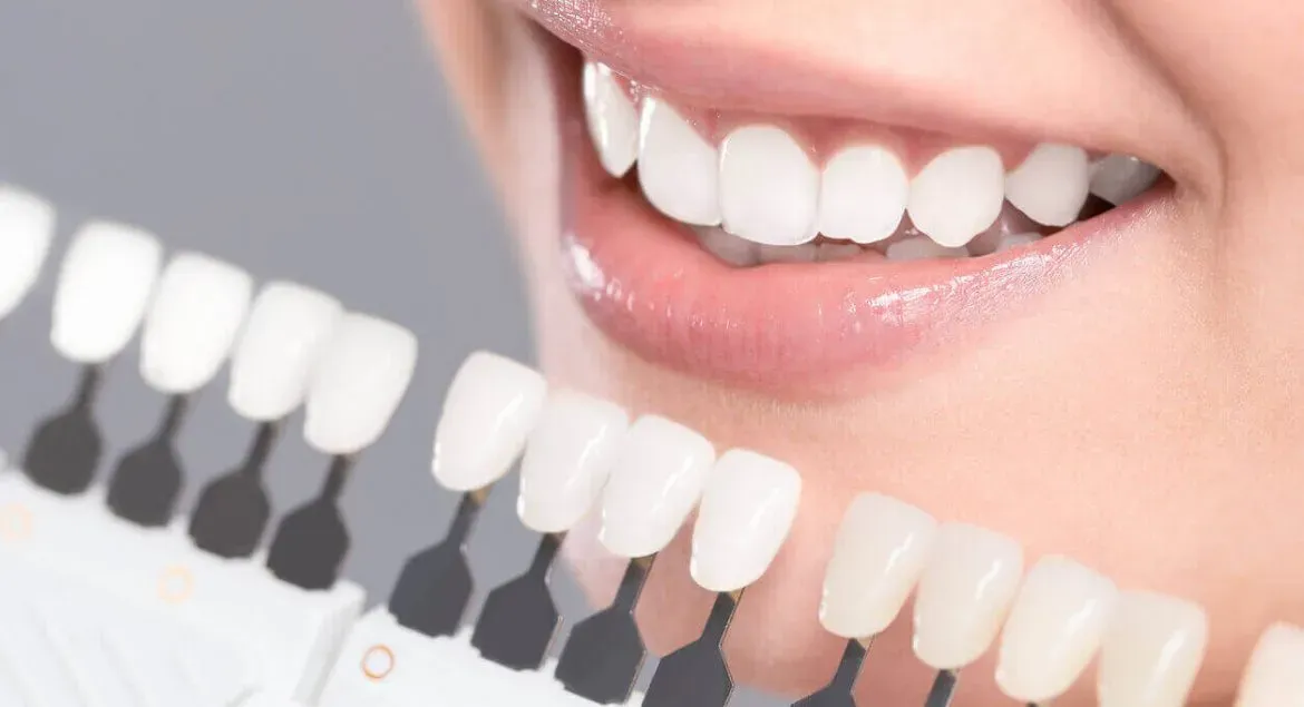 What problems can Dental Veneer fix? 