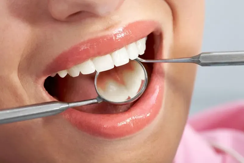 About Dental Composite