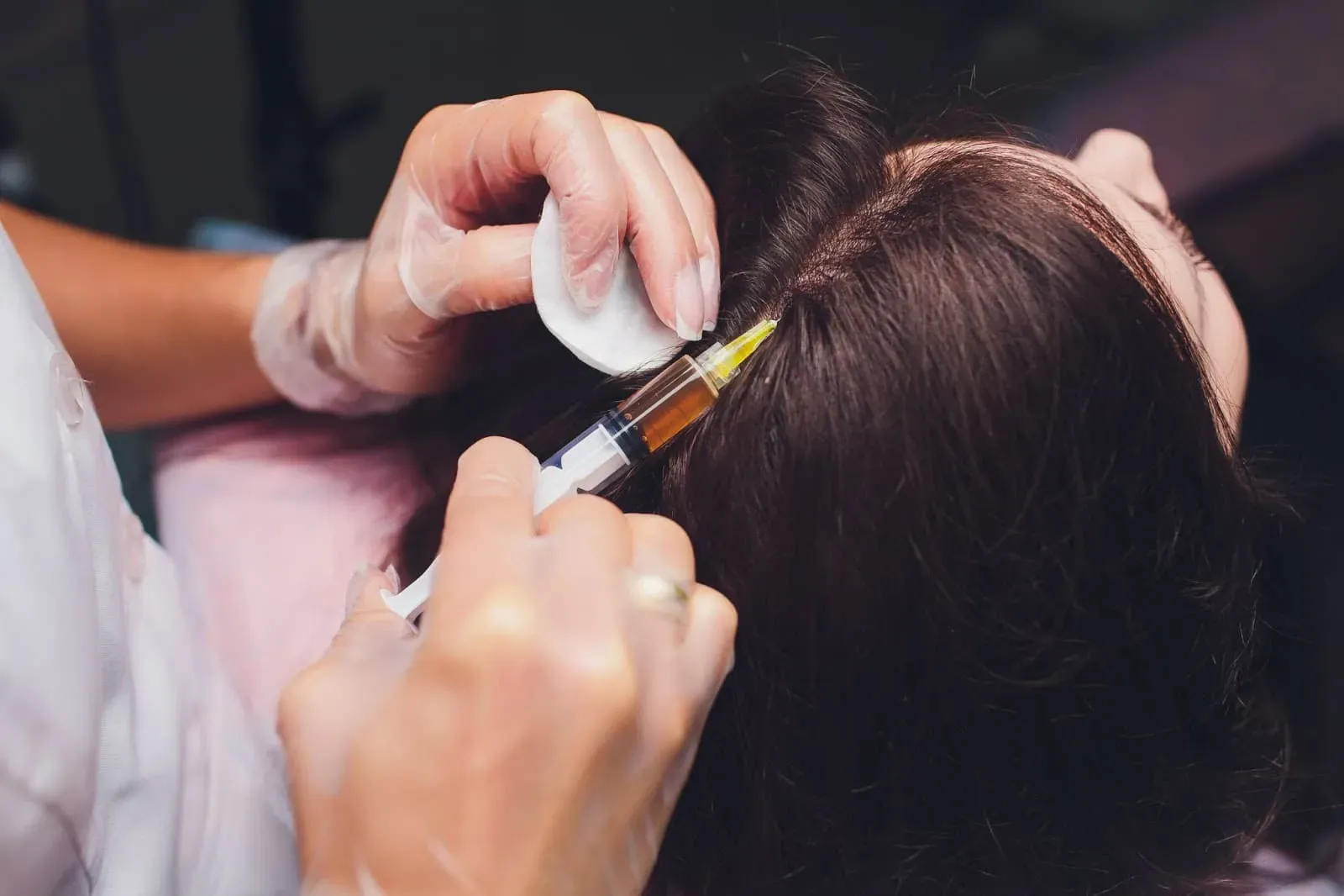 Hair Filler in Iran