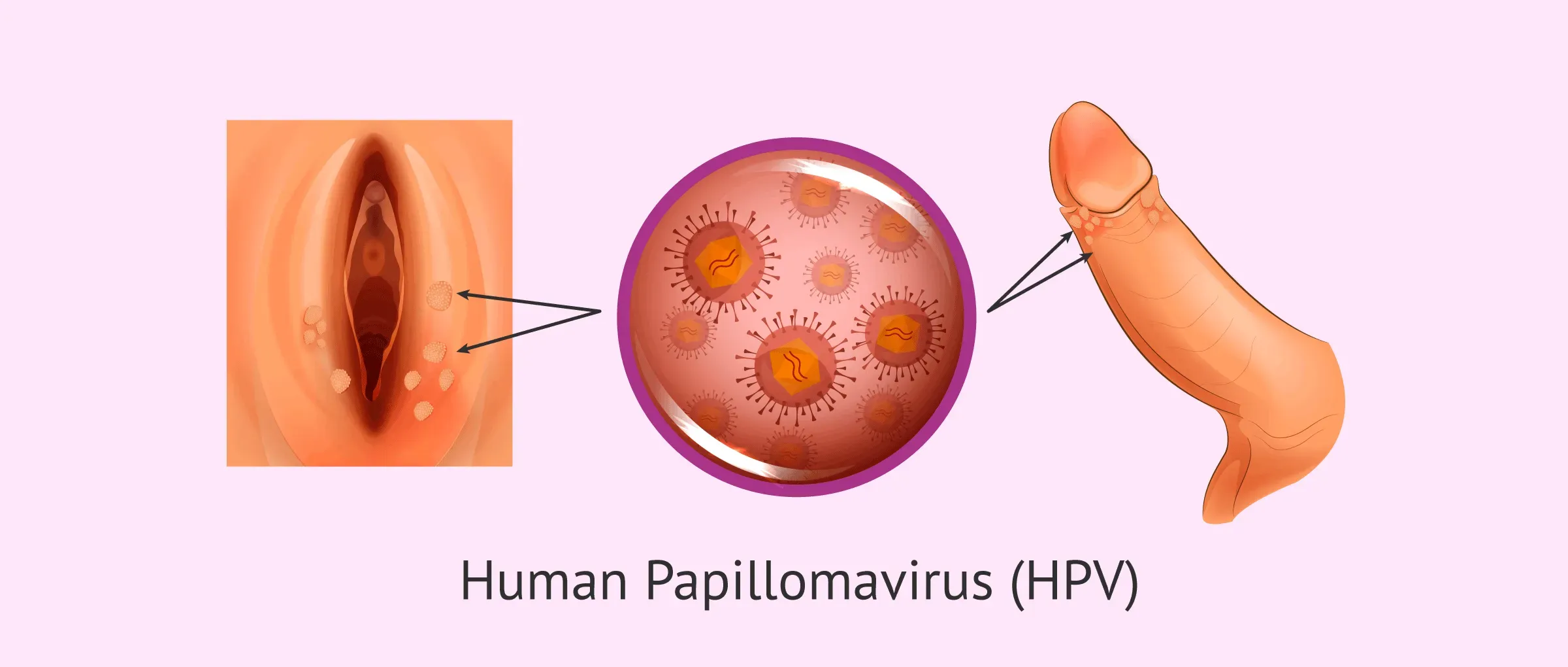 About Human Papillomavirus (HPV)