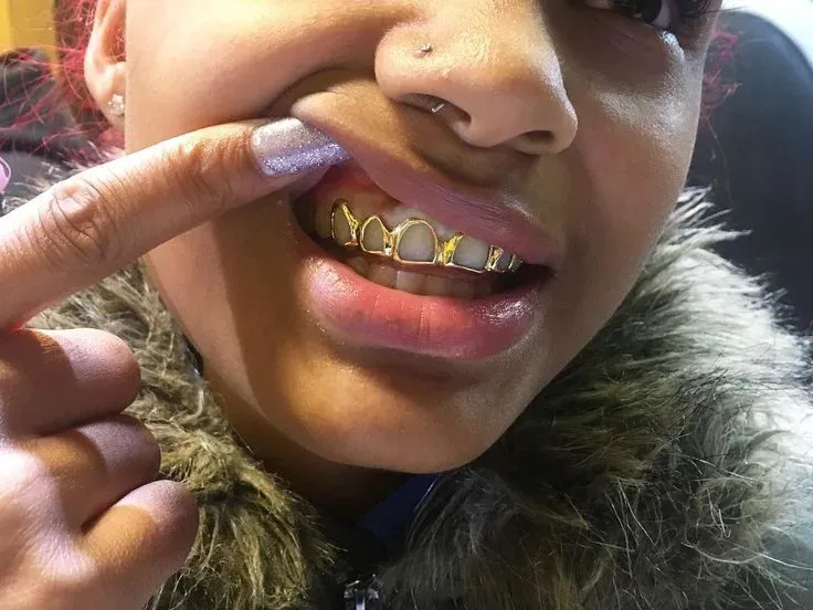 Tooth Jewelry in Iran