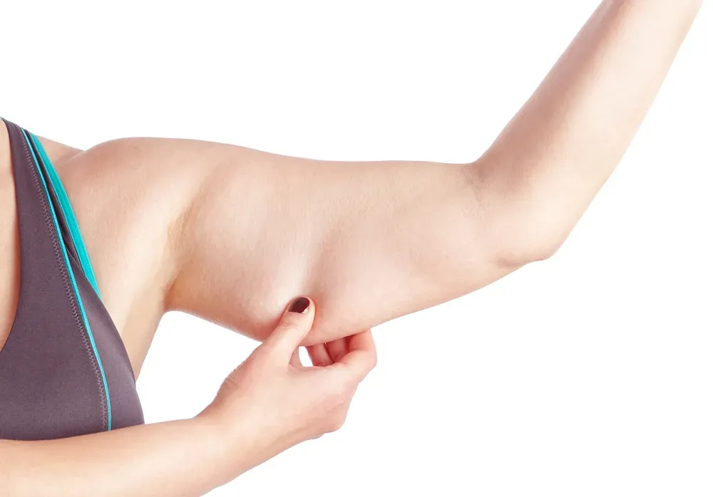 What are the benefits of an Arm Lift?