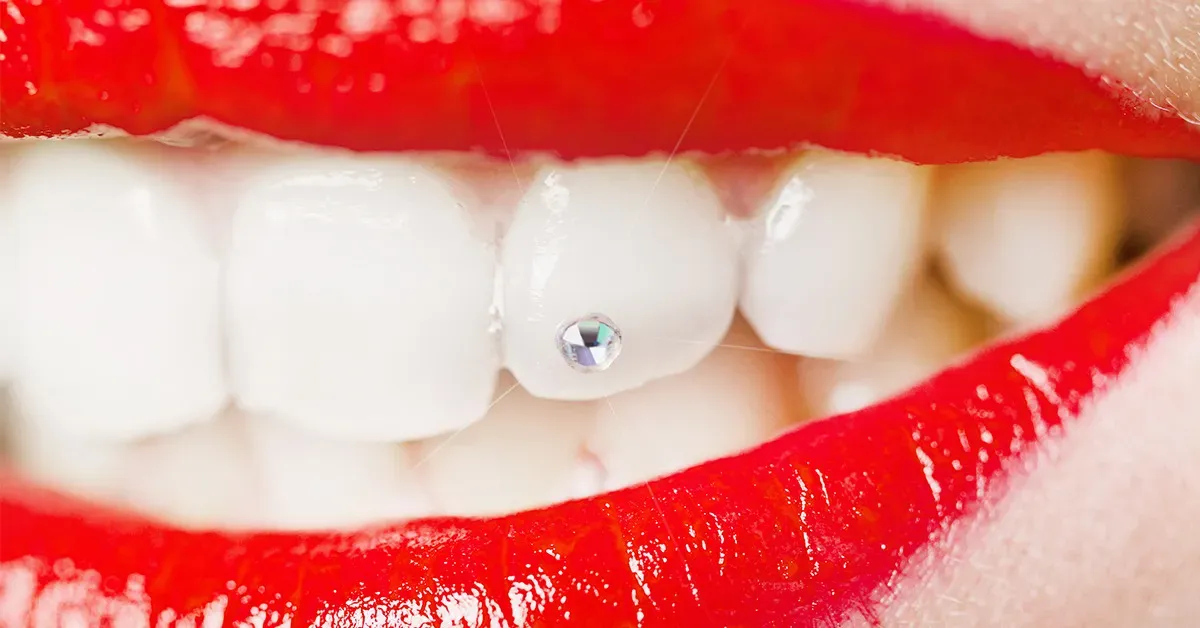 About Tooth Jewelry