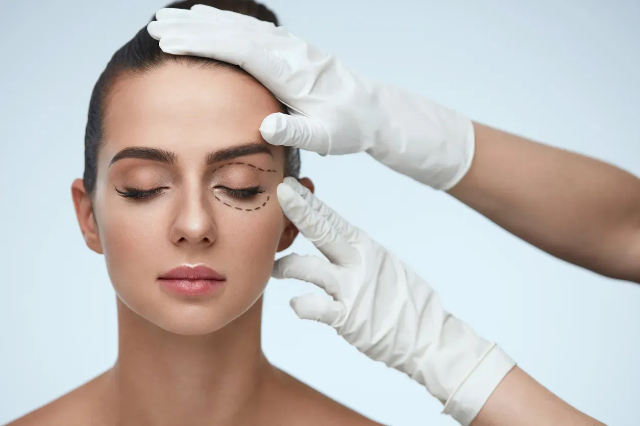 Why is Blepharoplasty performed?