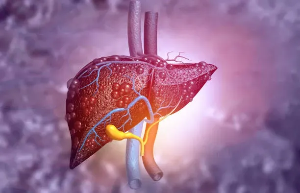 Why is a liver transplant performed? 