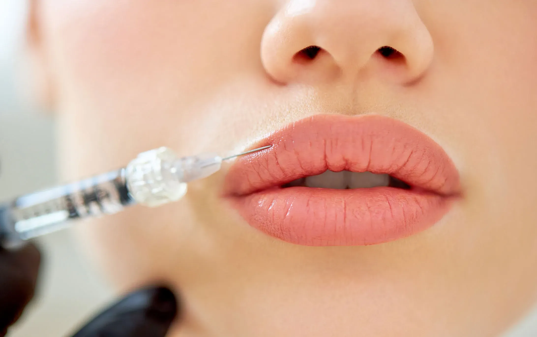 Which areas can Dermal Fillers enhance?