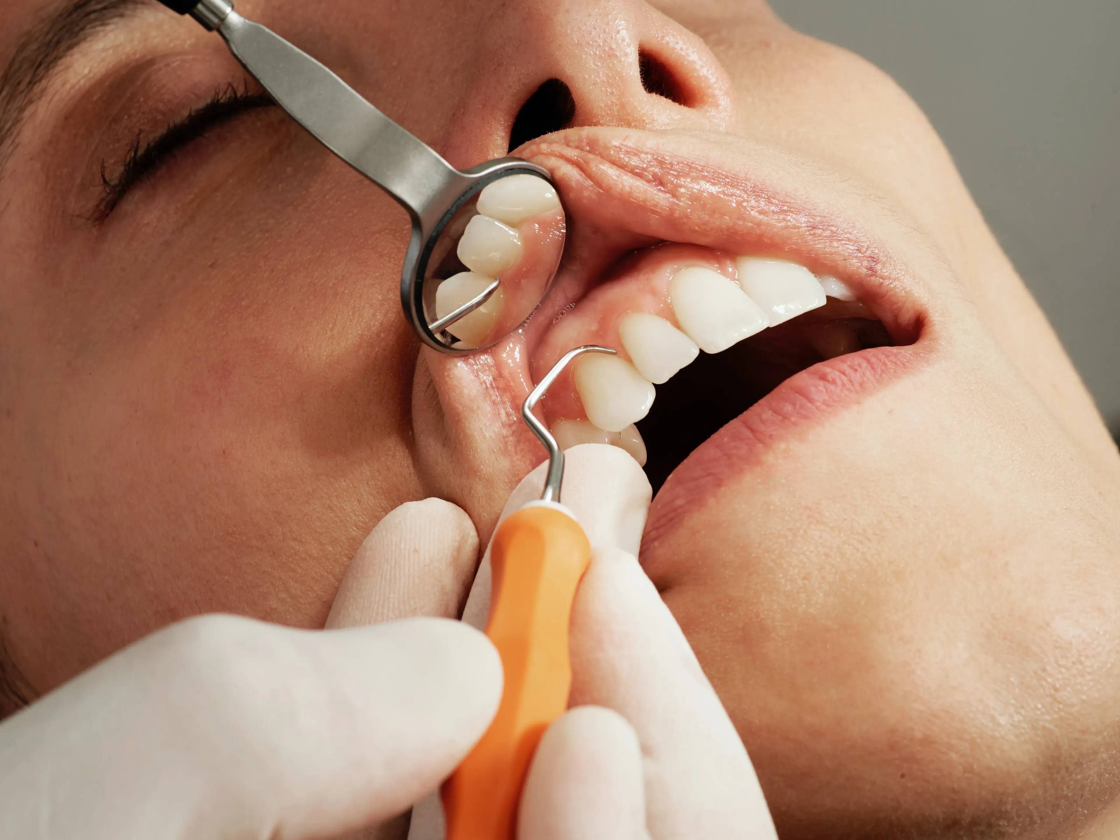 Best Candidates for Dental Implant Surgery 