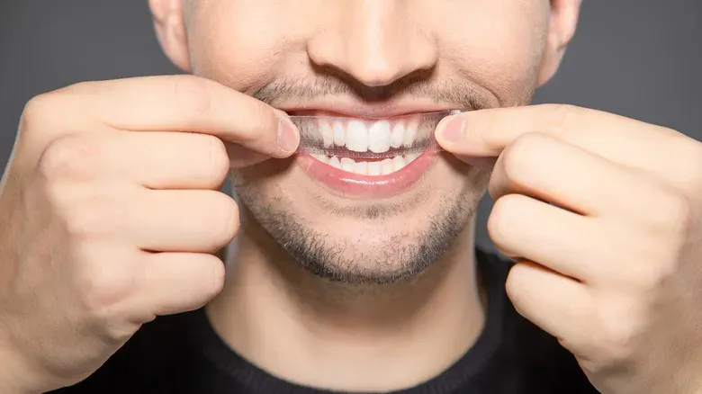 Type of Teeth Whitening 