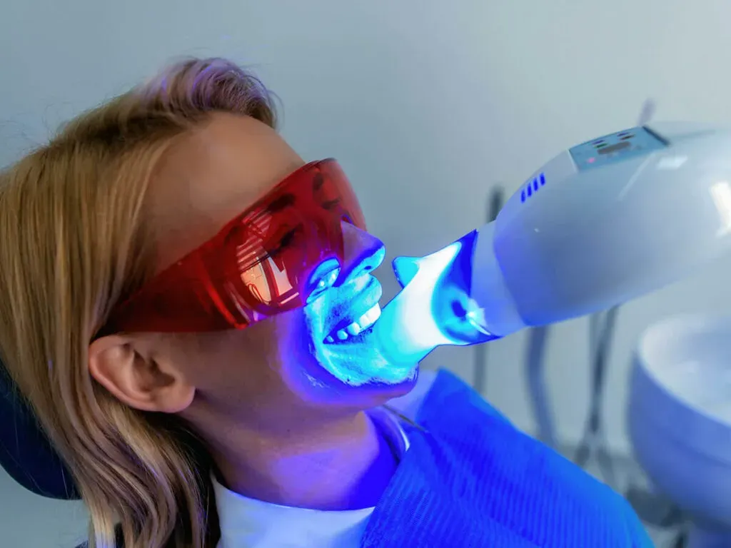 Everything you need to know before making your Teeth Whitening appointment