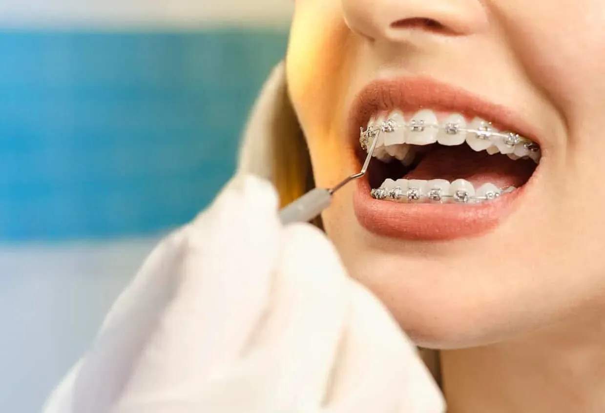 Orthodontics in Iran