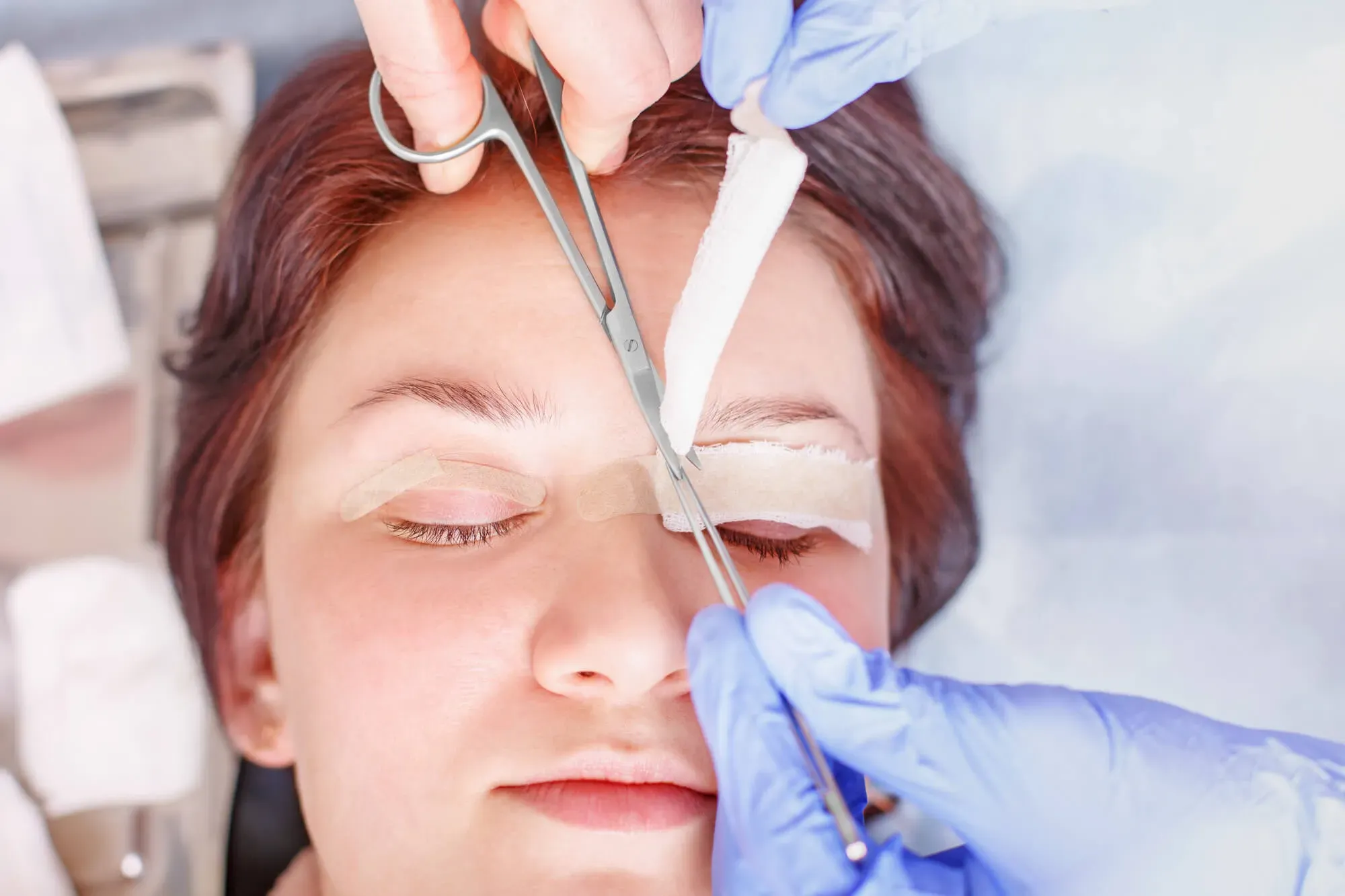 Role of Upper-Blepharoplasty in Facial Rejuvenation